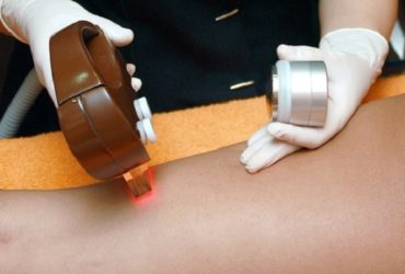 Revolutionary Hair Removal Techniques